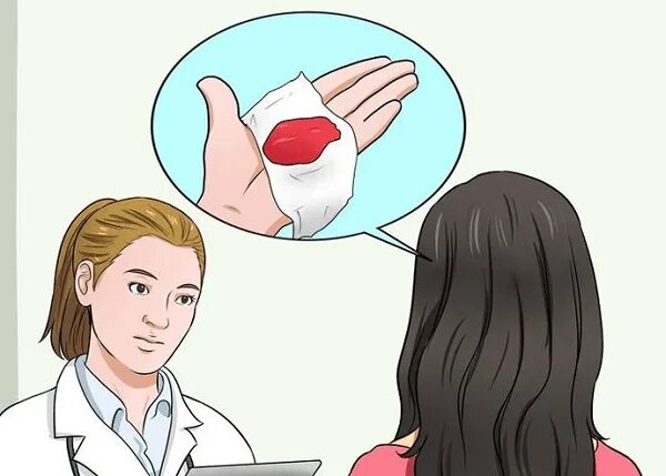 Импантационноекровотечение. Менструальный цикл сильное кровотечение. Препарат приостанавливающий месячные. Сильное кровотечение у женщин. Симптомы кровопотери при маточном кровотечении.