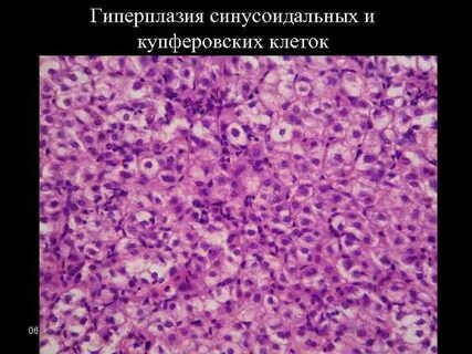 Купферовские клетки печени