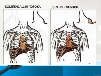 Порок п