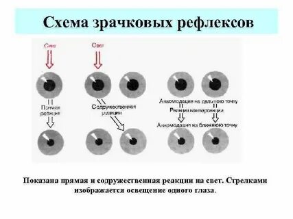 Реакция зрачка на боль