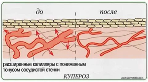 Кровеносные сосуды близко к поверхности кожи