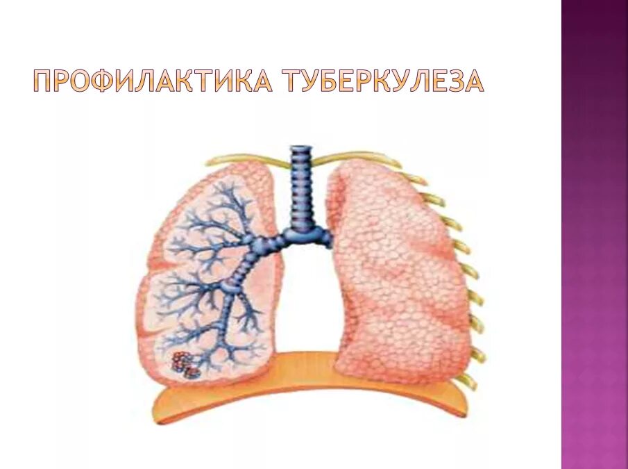 Внимание туберкулез. Профилактика туберкулеза. Профилактика туберкулеза легких. Профилактика туберкулеза картина.