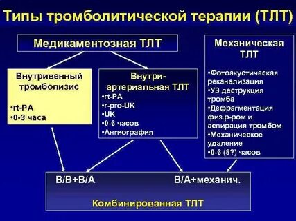 Тромболизис при инсульте