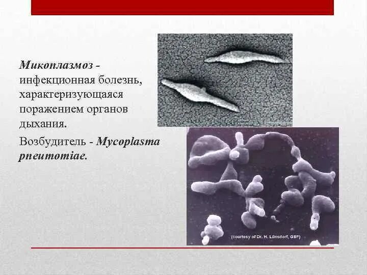 Микоплазмоз как передается. Возбудитель микоплазмоза. микоплазмоз заболевание. микоплазмоз презентация.