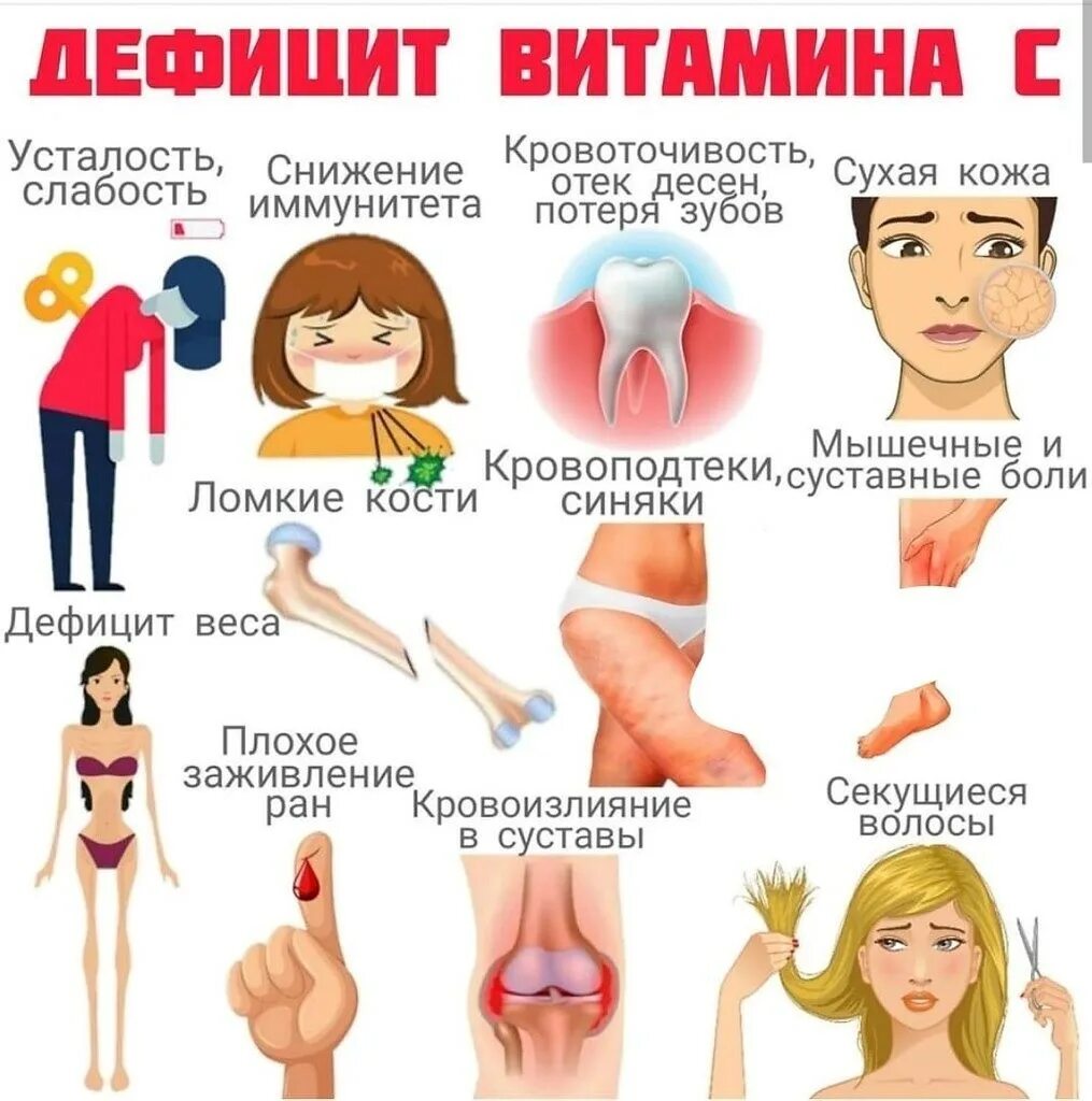 Дефицит витамина это что. Заболевания при недостатке витамина е. Недостатокивитамтна к. Признаки дефицита витамина с. Авитаминоз заболевание вызванное нехваткой.