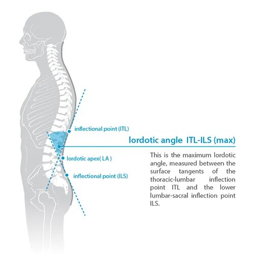 Угол кифоза рентген измерение. Измерение поясничного лордоза на рентгене. Поясничный лордоз угол рентген. Лордоз поясничного отдела рентген. Back angle