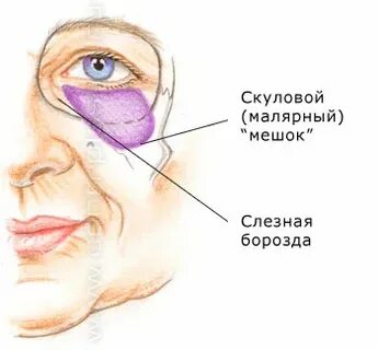 Как замаскировать малярные мешки
