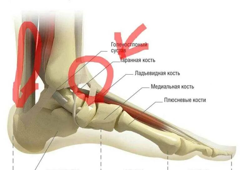 Болит стопа снизу