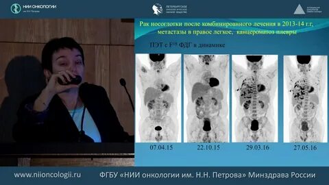 Мрт диффузия всего тела онкологический скрининг