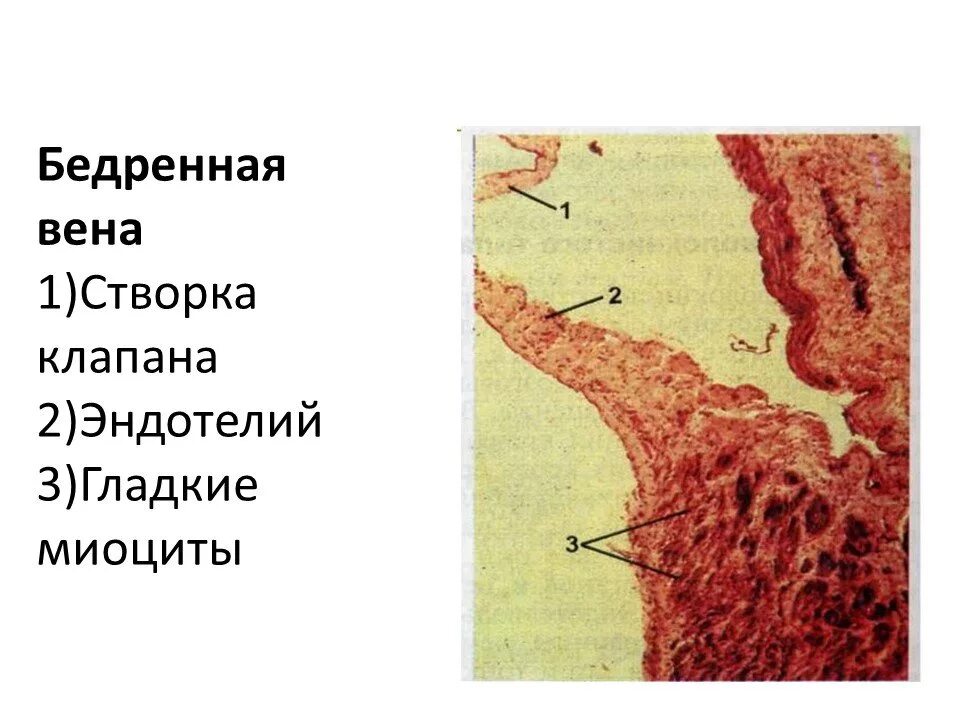 Вена препарат гистология. Вена мышечного типа бедренная вена препарат гистология. вена мышечного типа бедренная вена препарат. бедренная вена препарат. бедренная вена препарат гистология.