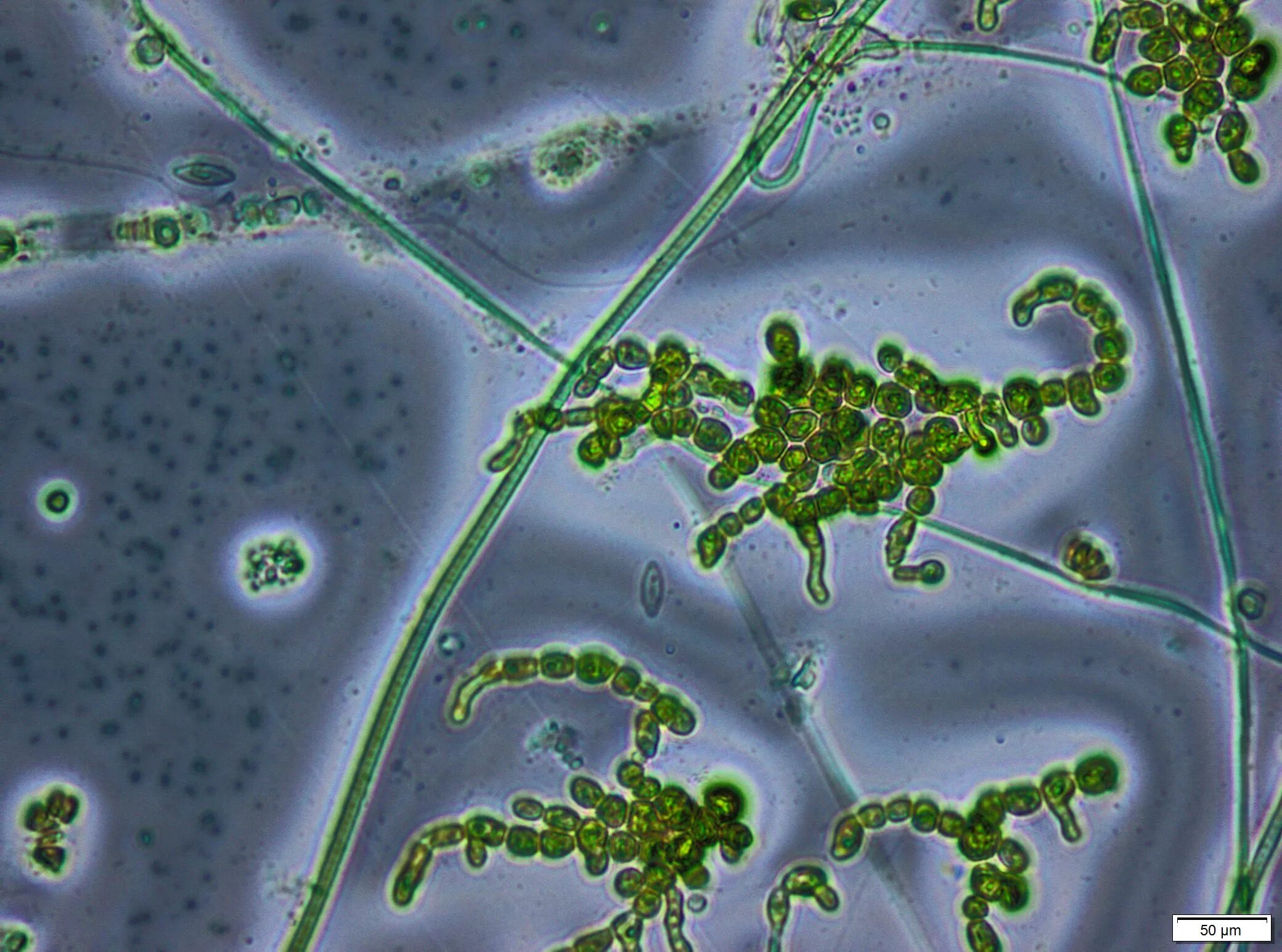 Цианобактерия Анабена. Цианобактерии и актиномицеты. Доядерные цианобактерии. Цианобактерии прокариоты. Группы организмов цианобактерии