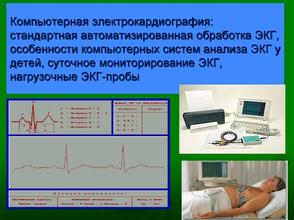 Обработка ЭКГ. Компьютерная электрокардиография. Методика регистрации ЭКГ. Регистрация ЭКГ. Компьютерный экг