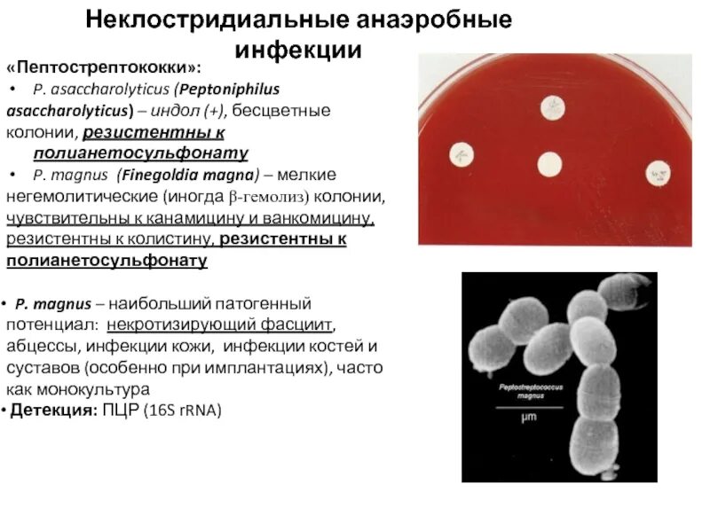 Peptostreptococcus. Возбудители неклостридиальной анаэробной инфекции микробиология. Пептострептококки патогенез. Неклостридиальная анаэробная микрофлора. Пептострептококки микробиология характеристика.