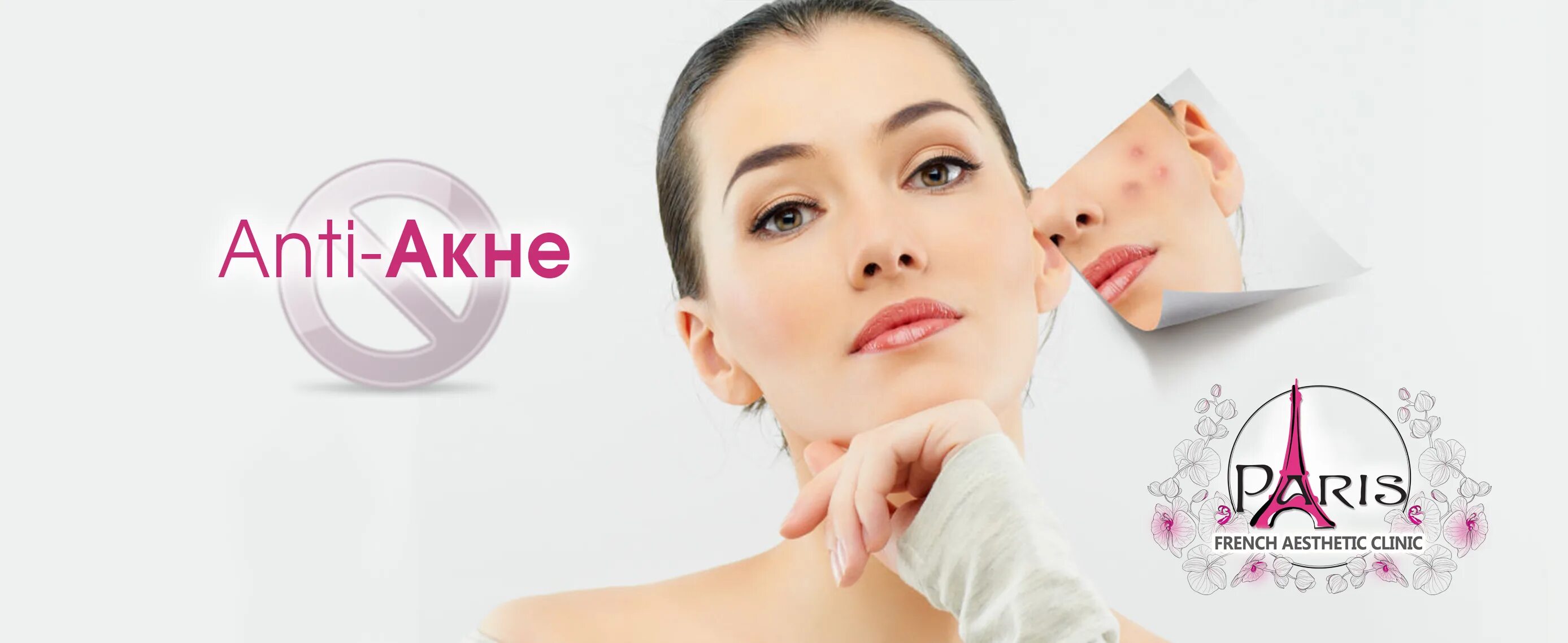 Акне реклама. Анти акне реклама. Acne program