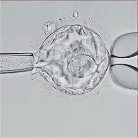 Пгт эмбрионов. Предимплантационная диагностика эмбрионов. Пгт-а эмбрионов генетико. Результаты пгд эмбриона. Экстракорпоральное оплодотворение рисунок.