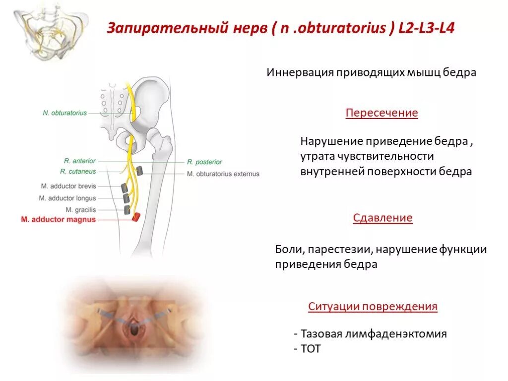 Невропатия полового нерва. Запирательный нерв анатомия топография. Запирательный нерв дерматом. Кожная ветвь запирательного нерва. Уровни поражения запирательного нерва.