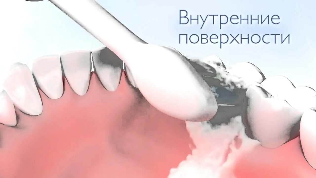 Правильно чистить зубы электрической щеткой видео. Зубы до и после электрической зубной щетки.