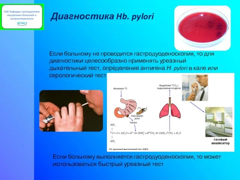 Уреазный дыхательный тест как проводится. 13с-уреазный дыхательный тест. 13с-уреазный дыхательный тест заключение. Быстрый уреазный тест. Дыхательный тест на хеликобактер пилори.