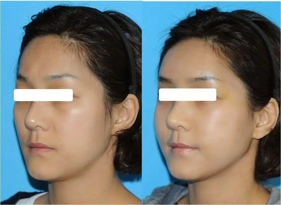 смс. клиника пластической хирургии биос. био ринопластика век. пластические операции. биос пластическая хирургия.