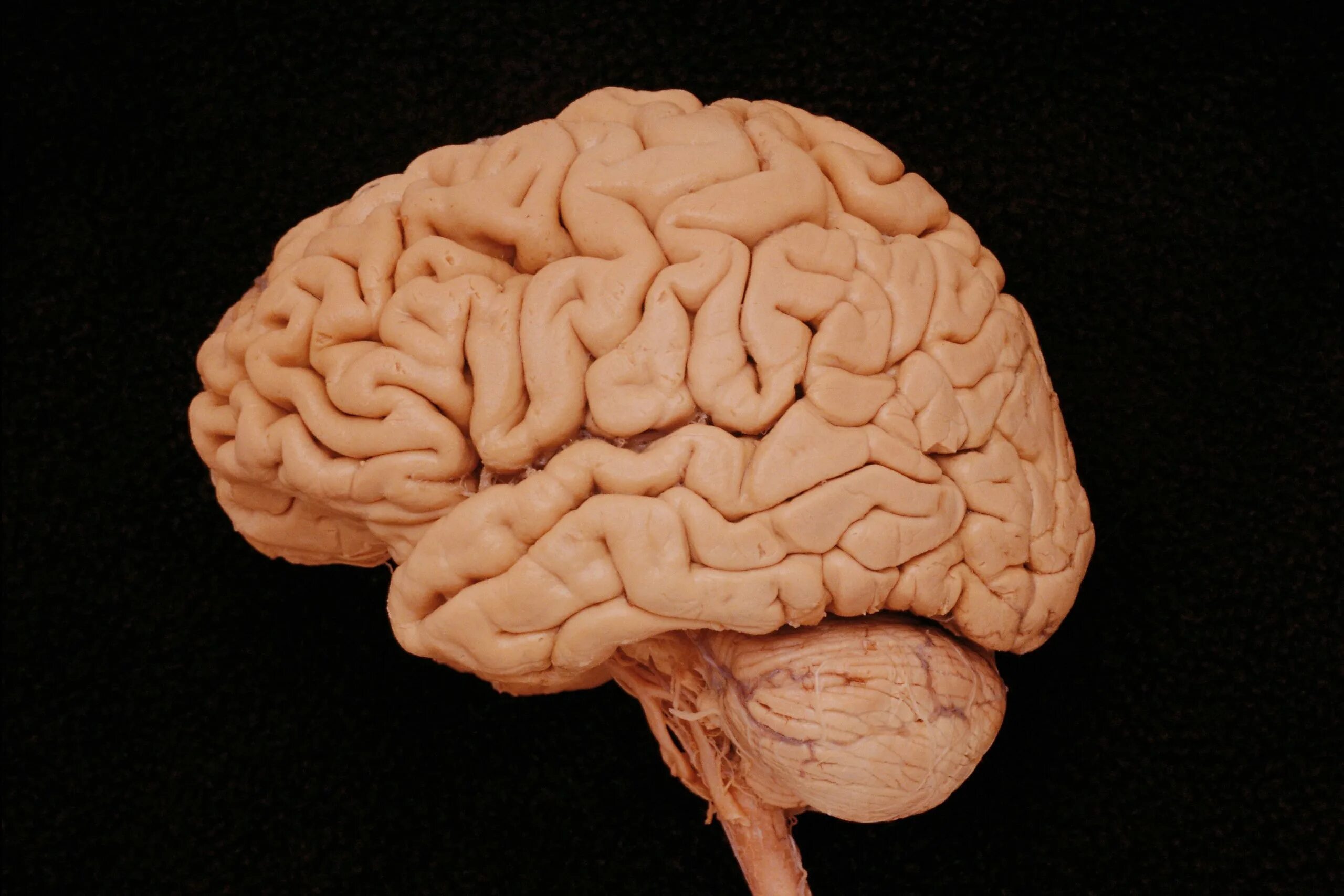 Картинки головного. Головной мозг.