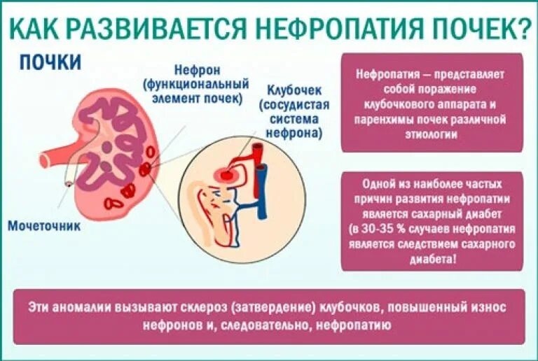 Ишемия почек. Диабетическая нефропатия симптомы.