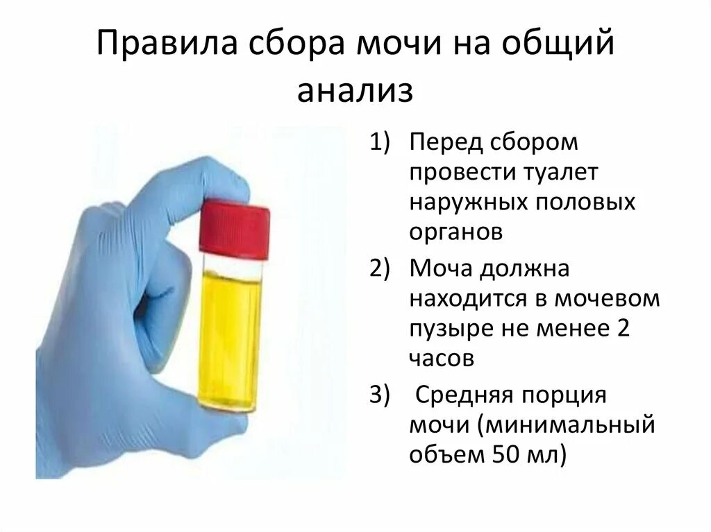 Как нужно сдавать мочу. Методика сбора мочи на общий анализ. Правило сбора мочи для общего анализа. Памятка для сбора мочи для общего анализа мочи. Для общего клинического анализа мочу собирают.