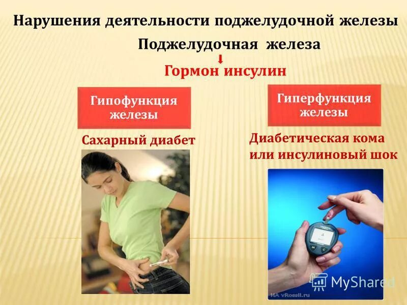 Какое заболевание развивается при гипофункции поджелудочной железы. Какое заболевание развивается при гипофункции поджелудочной железы. Гипер и гипофункция поджелудочной железы. Инсулин гиперфункция и гипофункция. Поджелудочная железа гипофункция и гиперфункция.