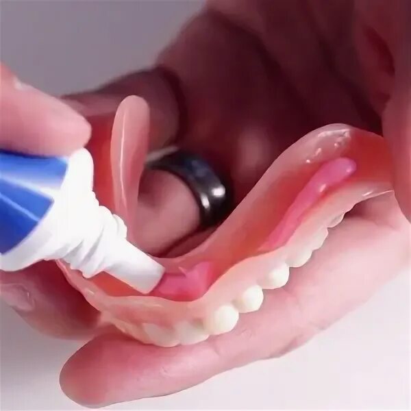 Чем можно приклеить зуб. Заклеить зубной протез. Клей для сломанного зубного протеза. Нанесение фиксирующего крема на зубной протез.