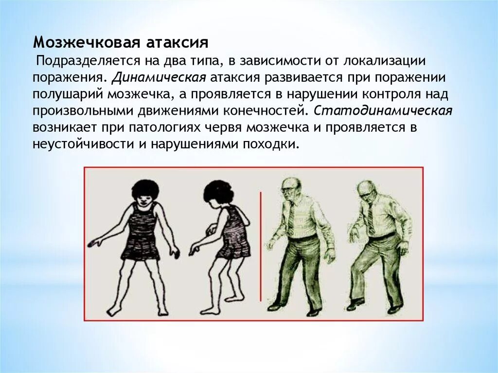 Нарушается координация движения. Атаксия при повреждении мозжечка. Мозжечкавая емиетаксия. Походка при мозжечковой атаксии. Походка при поражении мозжечка.