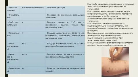 Анализ кожные пробы