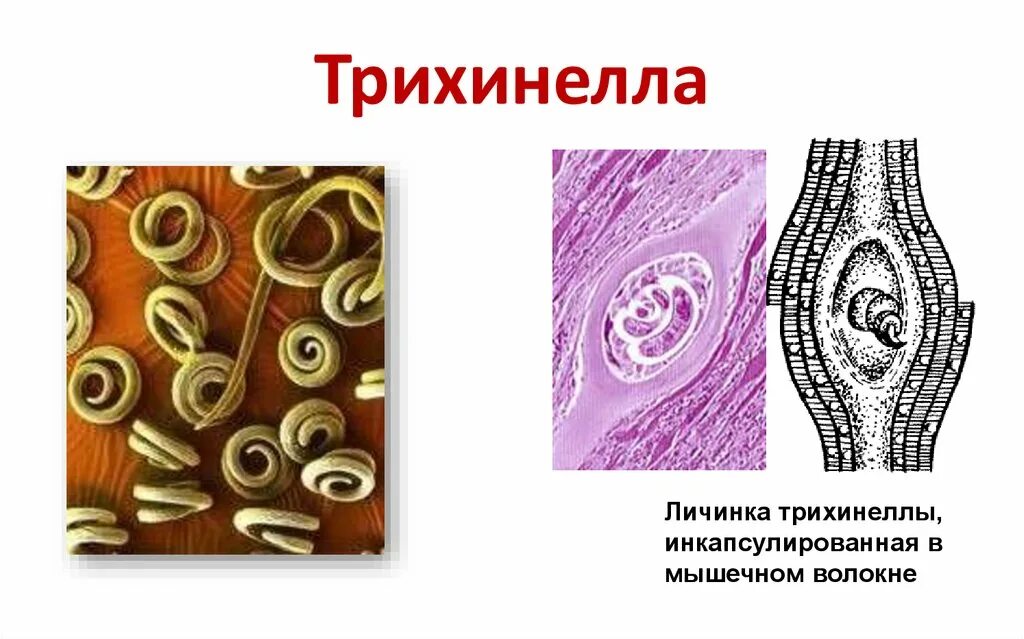 Инкапсулированная личинка трихинеллы. Строение личинки трихинеллы в мышцах. Личинки трихинелл в мышечной ткани. Инкапсулированные личинки трихинеллы (Trichinella spiralis).