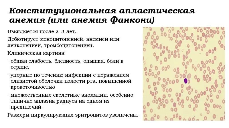 Анемия прогноз. Гипопластической анемии картина крови. Гипопластическая и апластическая анемия. Клинические синдромы при апластической анемии. Картина крови при апластической анемии.