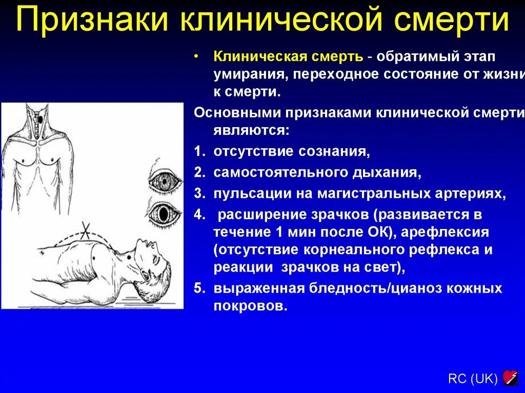 Чем отличается клиническая смерть от биологической смерти. Признаки клинической смерти. Признаки клинической. Марти. Признаки клиническойсмерьти. Основные признаки клинической смерти.