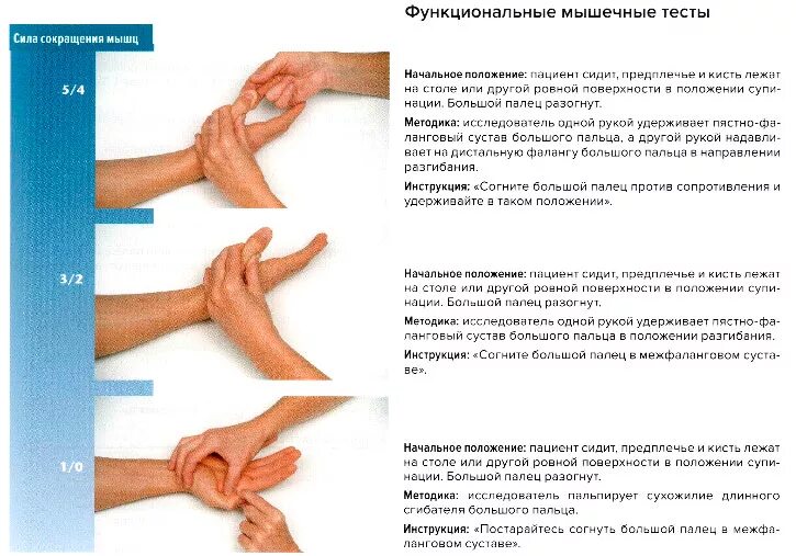 Болит указательный палец левой руки при сгибании. Указательный палец правой руки. Тендовагинит сухожилий разгибателей кисти. Немеют пальцы на левой руке мизинец. Болит указательный палец левой руки при сгибании.