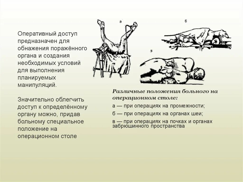 Положение больного на столе. Способы укладки пациента на операционном столе. Позиции пациента на операционном столе при различных операциях. Перечислить положения больного на операционном столе. Положение больного при операциях на шее.