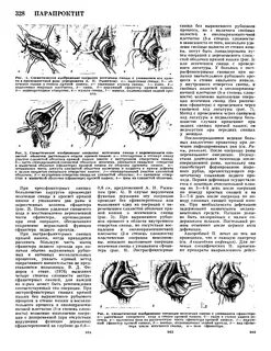 Как восстановить кишечник после операции