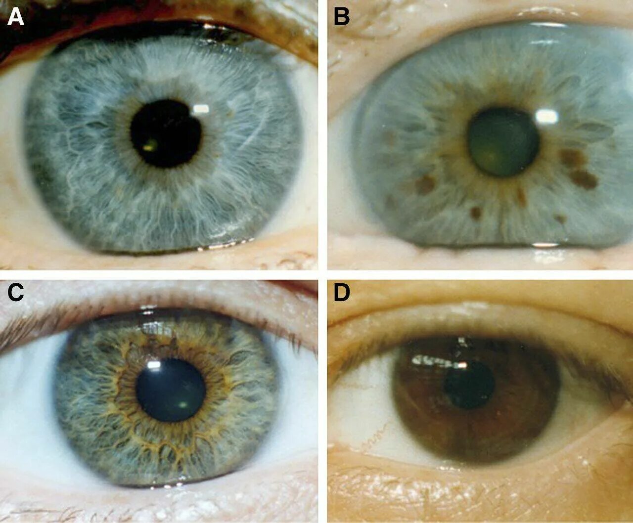 Цвет глаз человека определяется пигментацией. Цвет глаз. WDTRNF cukfp. Цвет глаз с вкраплениями.