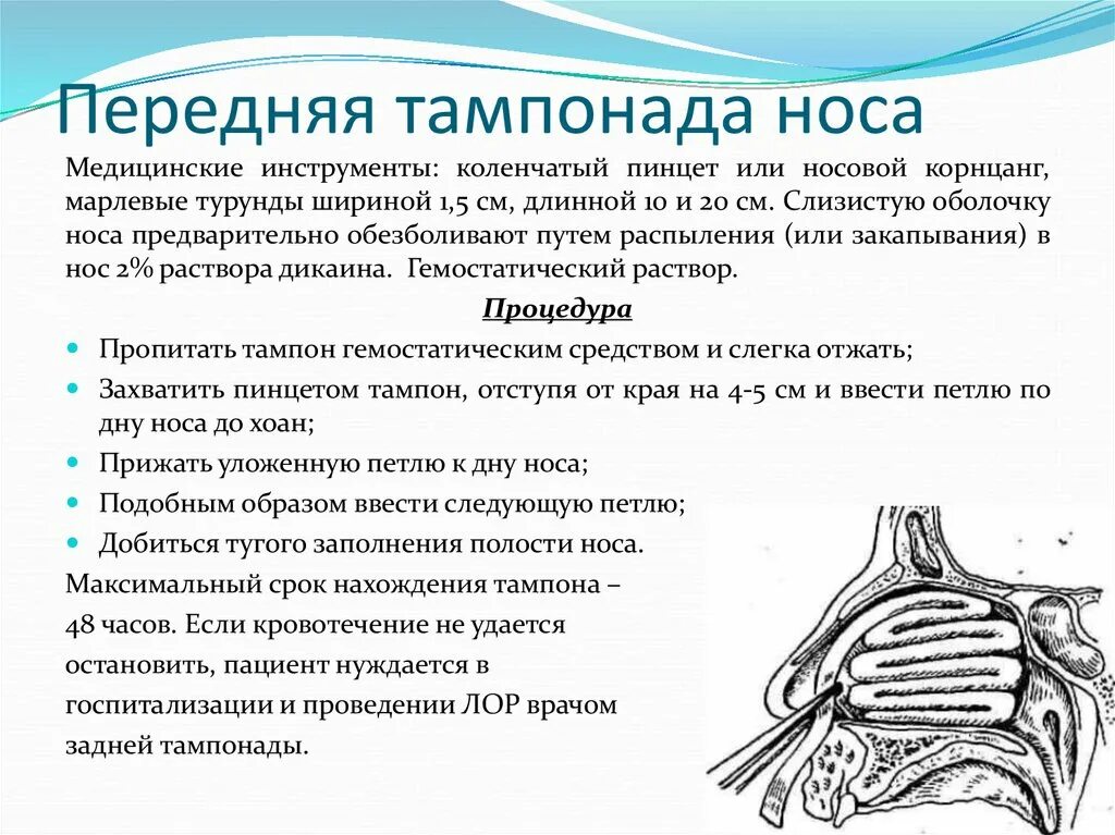 Тампонада носа при носовом кровотечении. Передняя и задняя тампонада при носовых кровотечениях. Передняя тампонада носовых ходов при носовом кровотечении. Передняя и задняя тампонада при носовом кровотечении алгоритм. Задняя тампонада полости носа алгоритм.