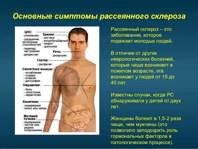 Склероз симптомы у мужчин на ранних стадиях. Рассеянный склероз симптомы у мужчин. Рассеянный склероз симпто. Россенисклероз симптомы. Расеянныймсклероз симптомы.