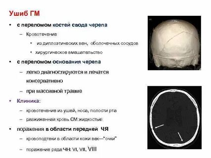 Чем могут сопровождаться переломы костей черепа