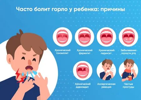Почему часто болит горло у взрослого причина
