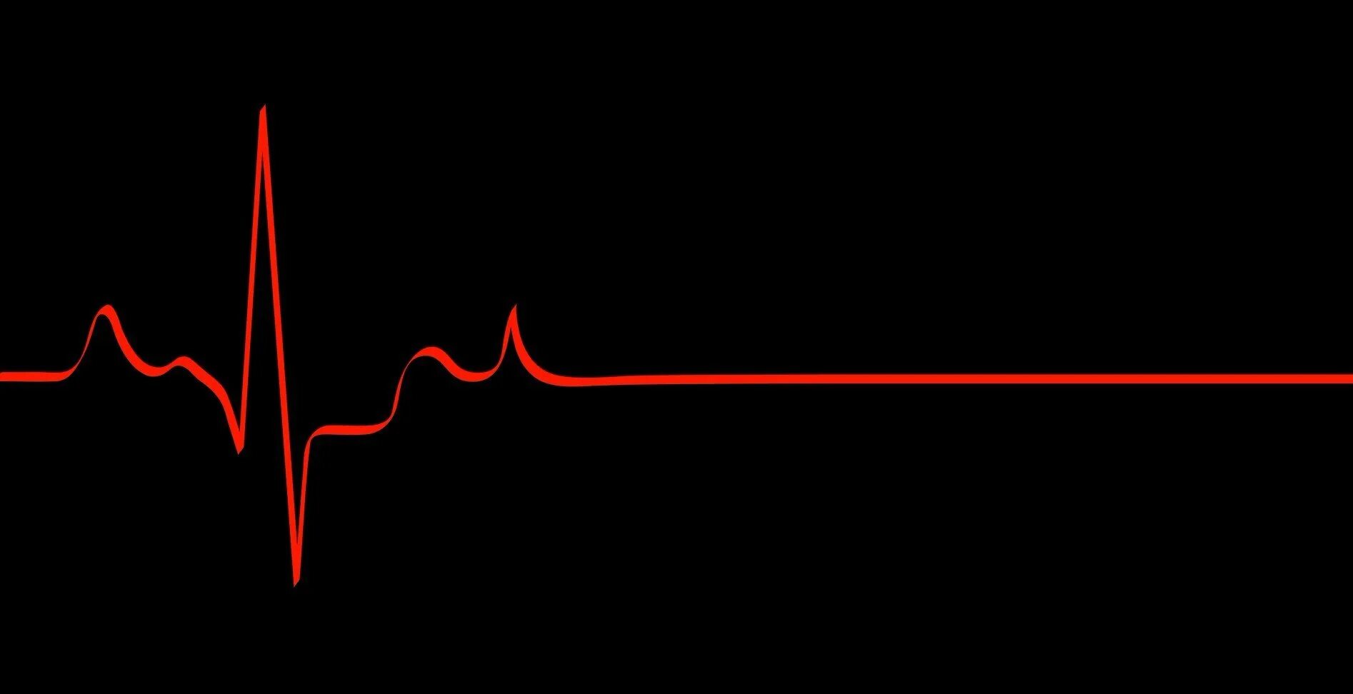 Пульс остановился. Кардиограмма сердца. Линия пульса. Пульс на черном фоне. Пульс остановка сердца.
