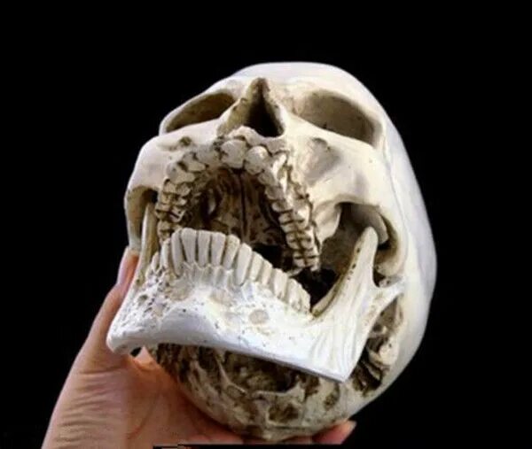 Как выглядят зубы у черепа человека Beautiful Collection of Human Skulls