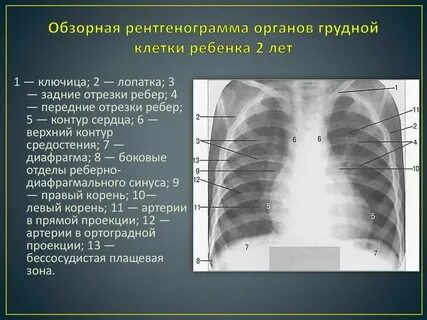 Грудные инфекции