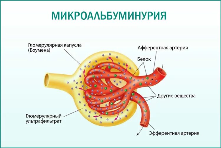 Повышен микроальбумин в моче у взрослого. Микроальбуминурия. Микроальбуминурия норма. Микроальбумины в моче норма. Нормы креатинина и микроальбумина в моче.