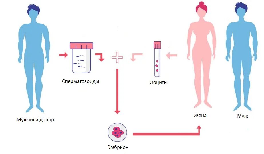 Донор для зачатия. Донорство яйцеклеток. Донорство гамет и эмбрионов. Эко с донорской яйцеклеткой. Донорские половые клетки.