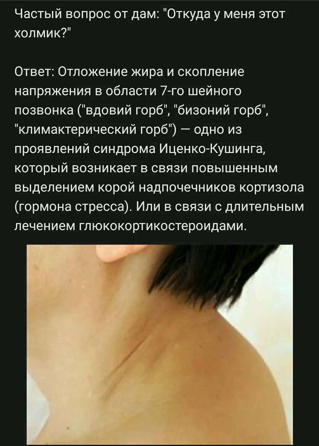 Почему появляется горбик. Холка вдовий горбик психосоматика.