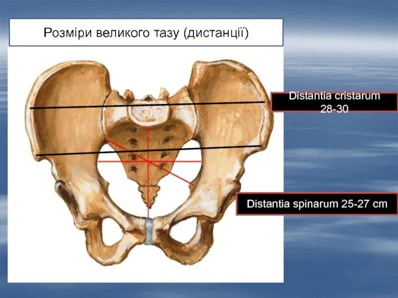 Дистанция кристанум таза. Дистанции женского таза. Кристарум трохантерика.