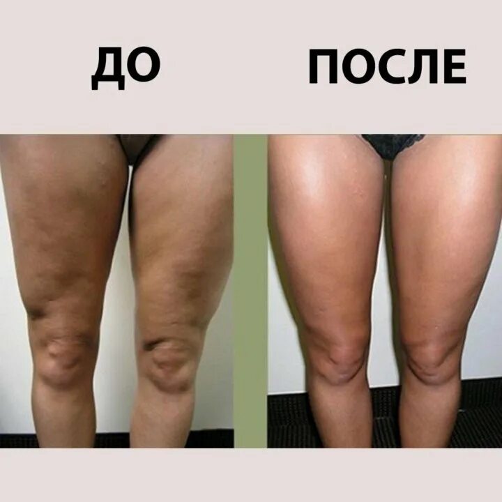 Услуги косметолога в Ряжске: 4 косметолога