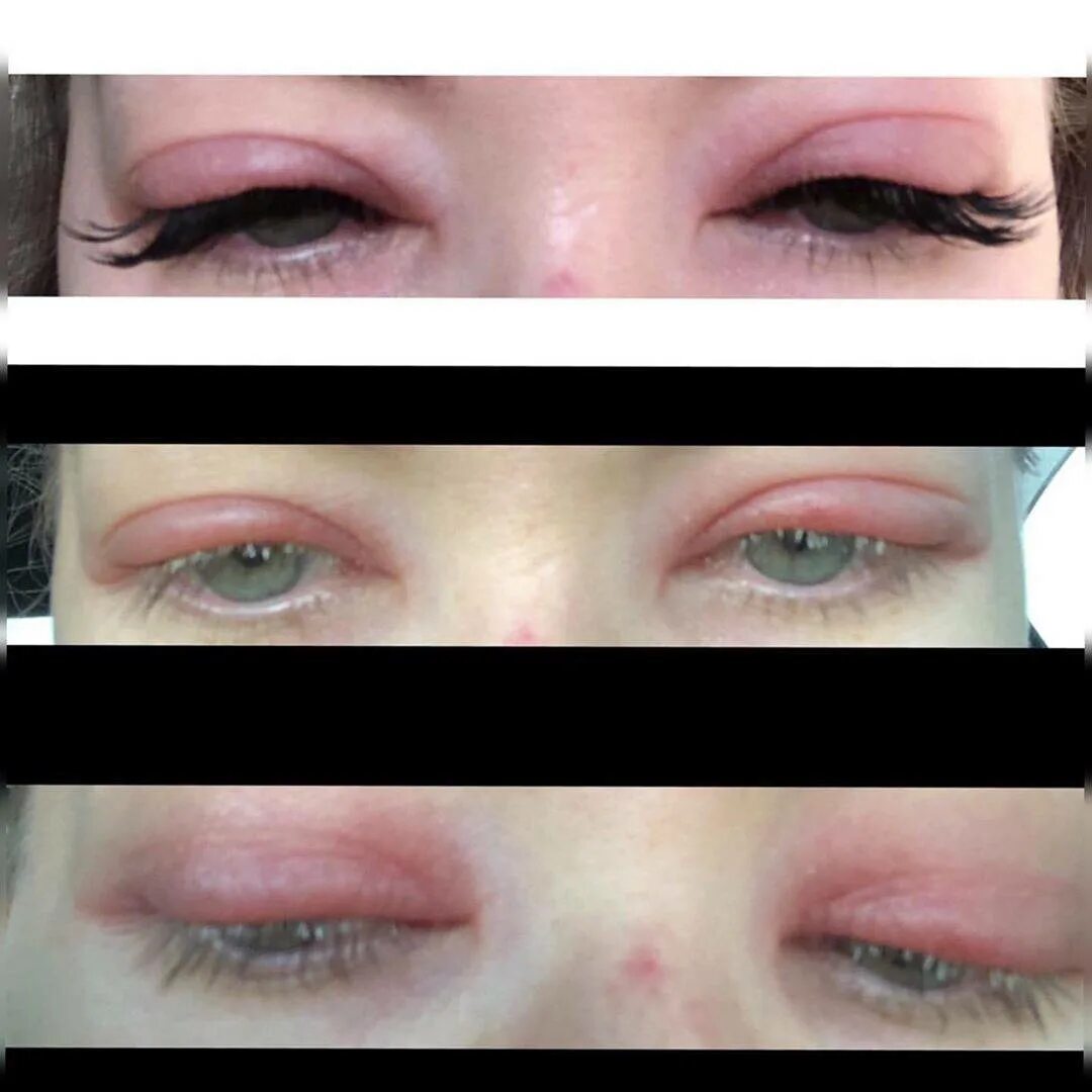СПОСОБ НАРАЩИВАНИЯ РЕСНИЦ "lash-to-lash"